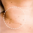 🌟🌟Tecnología segura y efectiva para una piel visiblemente mas limpia🌟🌟